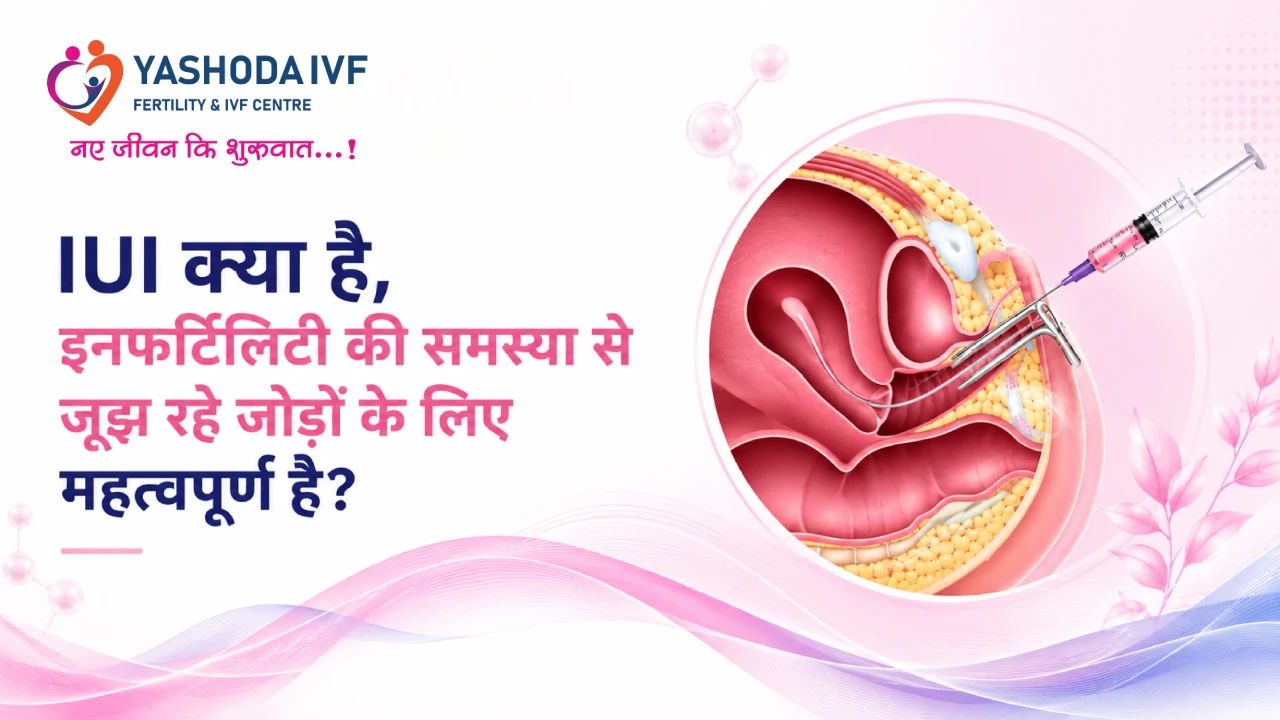 IUI Kya Hai? blog image from yashoda ivf